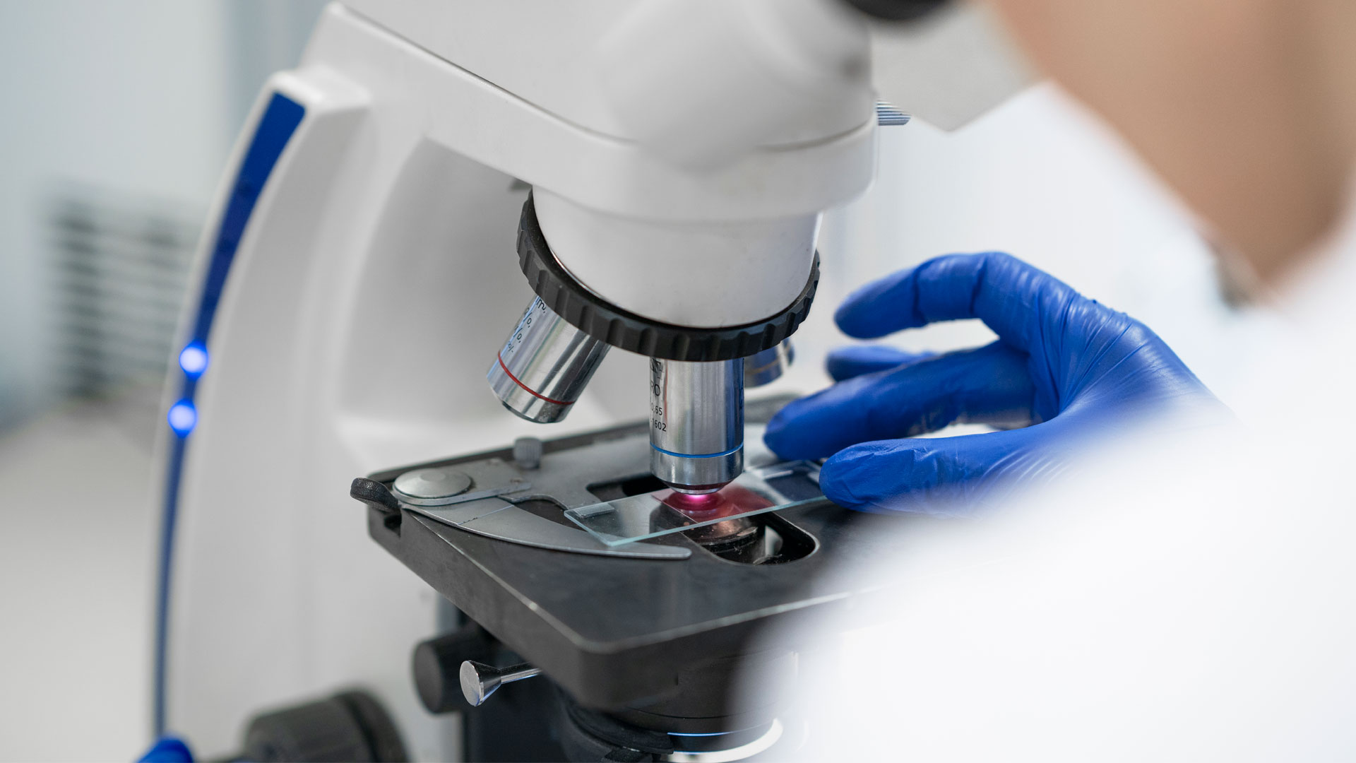 Διαγνωστικά κέντρα στην Πάτρα και η σχέση τους με την αιμοκάθαρση